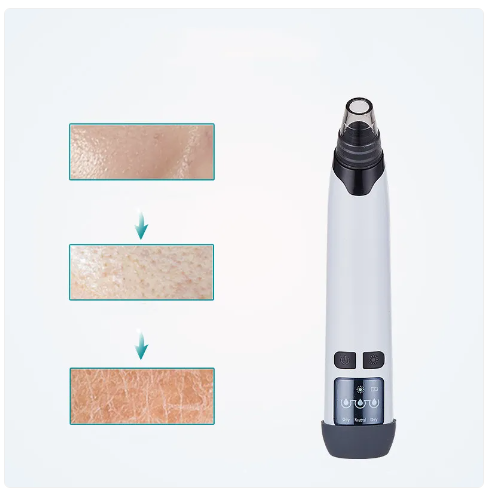 PORÉ Perfect Pore Blackhead Vacuum